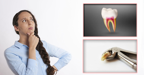 Root Canals vs. Extractions in Cathedral City