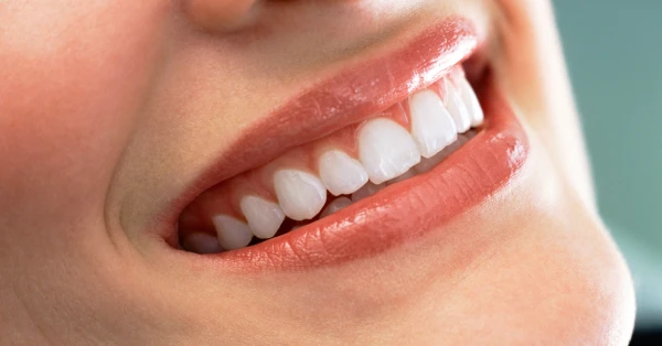 Close-up of a bright smile representing cosmetic dentistry in Desert Hot Springs