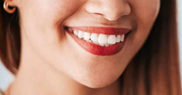 Debunking Top Myths About Teeth Whitening in Palm Desert Debunking Top Myths About Teeth Whitening in Palm Desert