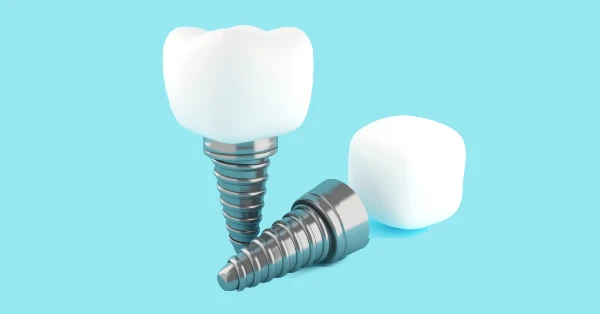 Eat, Speak, and Smile with Dental Implants in Palm Desert