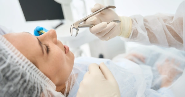 Essential Aftercare Tips for Tooth Extraction in Palm Desert