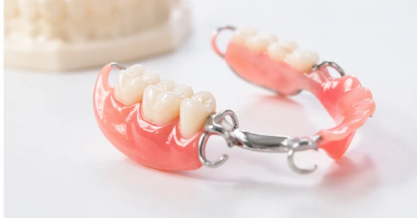 Removable partial denture appliance, showing how partial dentures in La Quinta help replace missing teeth