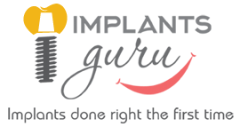 Implants Guru