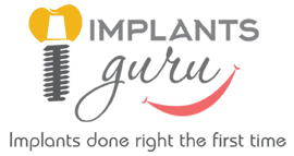 Implants Guru