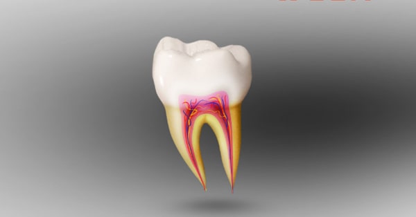 7 Symptom of Root Canal Treatment