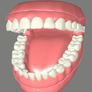 Complete and Partial Dentures in Rancho Mirage