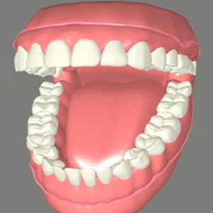 Complete and Partial Dentures Rancho Mirage, Palm Desert, Palm Spring, Coachella Valley, Cathedral City, La Quinta, Desert Hot Springs, Yucca Valley, Indian Wells