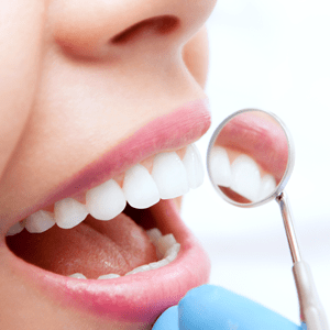 General Dentistry Services in Palm Desert