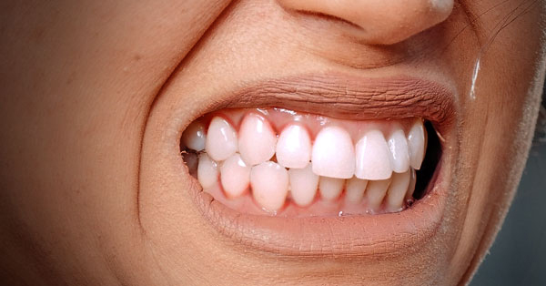 Gum Disease & Dental Implants: Oral Surgeon