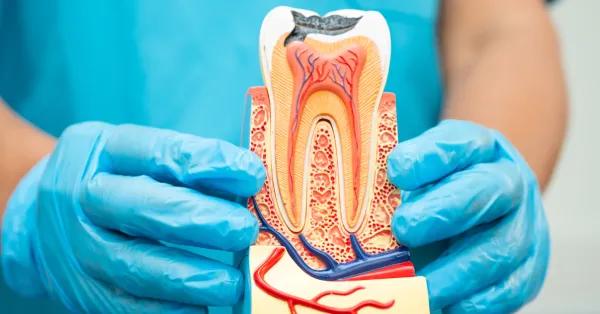 Myths About Root Canal Treatment in Palm Springs