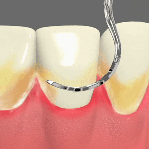 Periodontal Care Periodontal Care Rancho Mirage, Palm Desert, Palm Spring, Coachella Valley, Cathedral City, La Quinta, Desert Hot Springs, Yucca Valley, Indian Wells