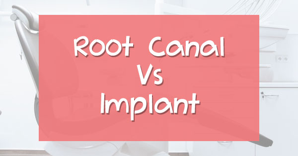 Root Canal Treatment Vs Dental Implants | Palm Desert Root Canal Treatment Vs Dental Implants | Palm Desert