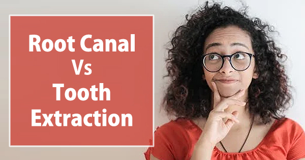 Root Canal Vs Tooth Extraction Which is Better