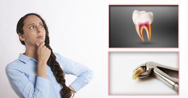 How Do Root Canals and Extractions Differ? How Do Root Canals and Extractions Differ?