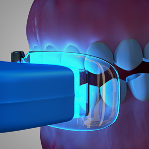 Tooth Whitening Tooth Whitening Rancho Mirage, Palm Desert, Palm Spring, Coachella Valley, Cathedral City, La Quinta, Desert Hot Springs, Yucca Valley, Indian Wells