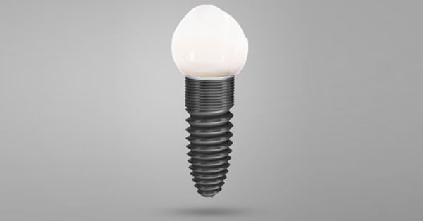 Top Dental Implant Specialist for Rancho Mirage and Surrounding Areas Top Dental Implant Specialist for Rancho Mirage and Surrounding Areas