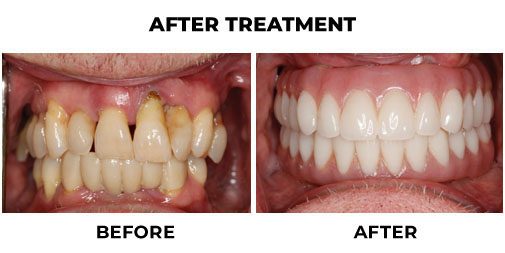 Case 4 - img2