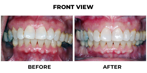 Case 11 - img1