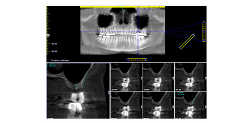 Case 14 - img2