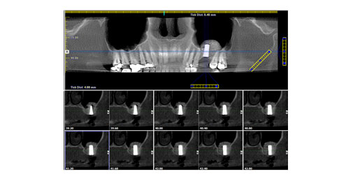 Case 14 - img5